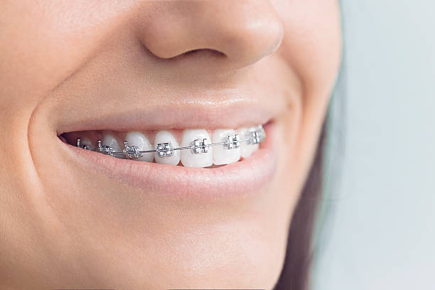 Full Mouth Reconstruction in Heath, OH